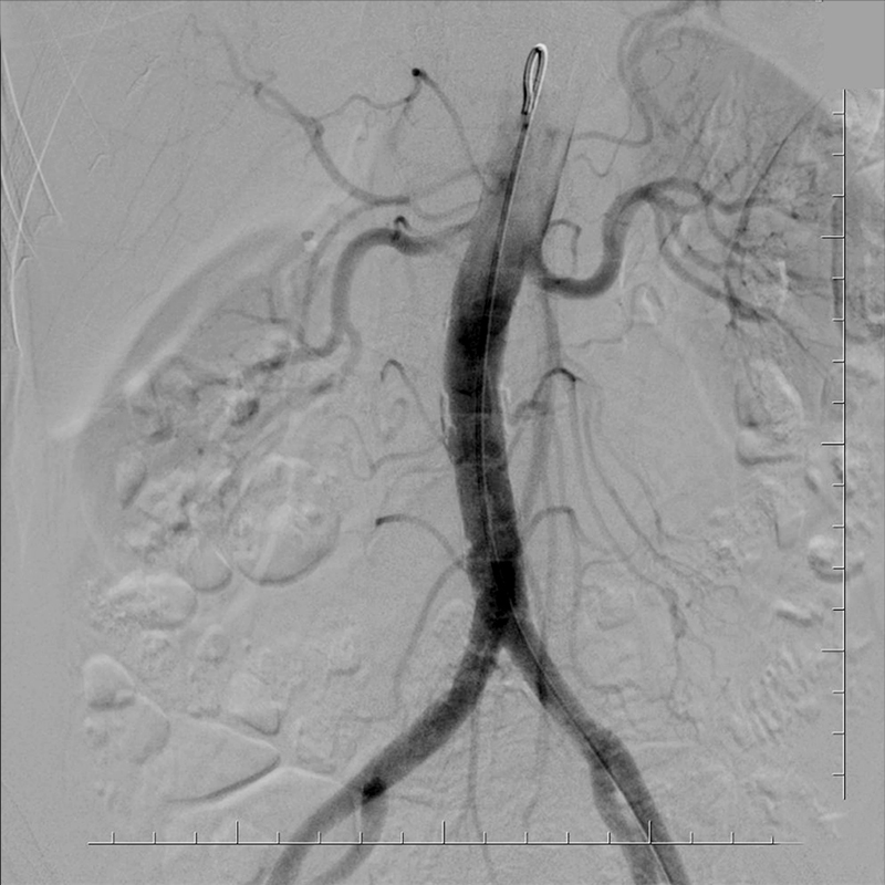 Canon Medical Streamlines Fluoroscopy And Radiography Exams With